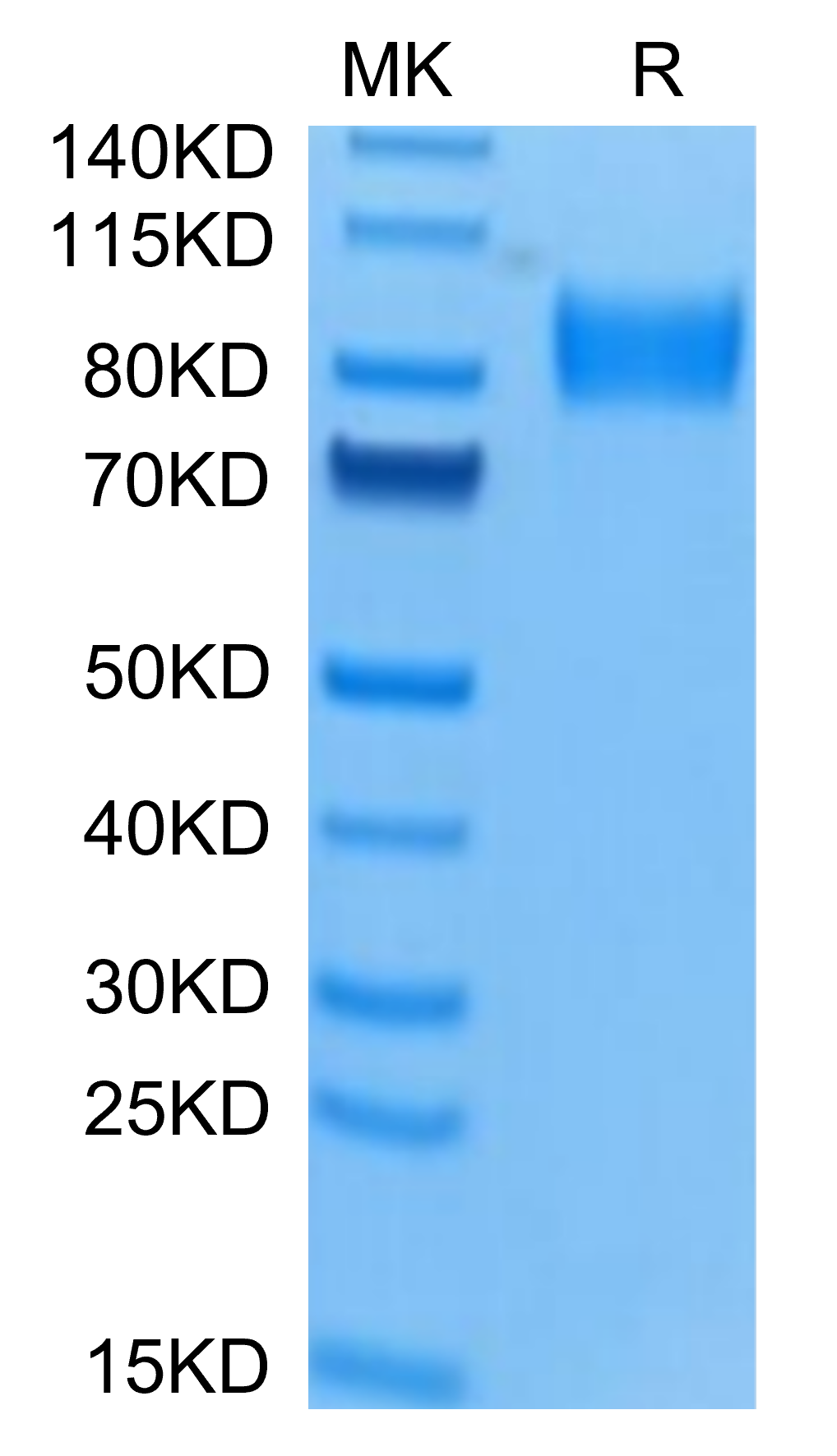 Human Osteoactivin/GPNMB Protein, Ultra Low Endotoxin (GNB-HM101-UL)