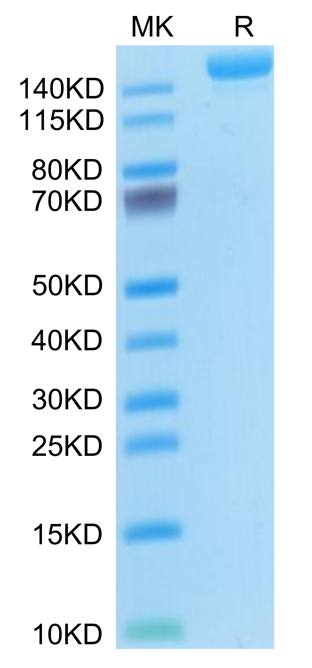 Mouse L1CAM Protein, Ultra Low Endotoxin (LAM-MM101-UL)
