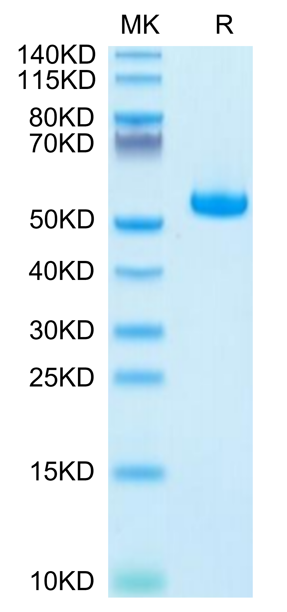 Human HLA-A*11:01&B2M&KRAS G12V (VVVGAVGVGK) Monomer Protein (MHC-HM421)