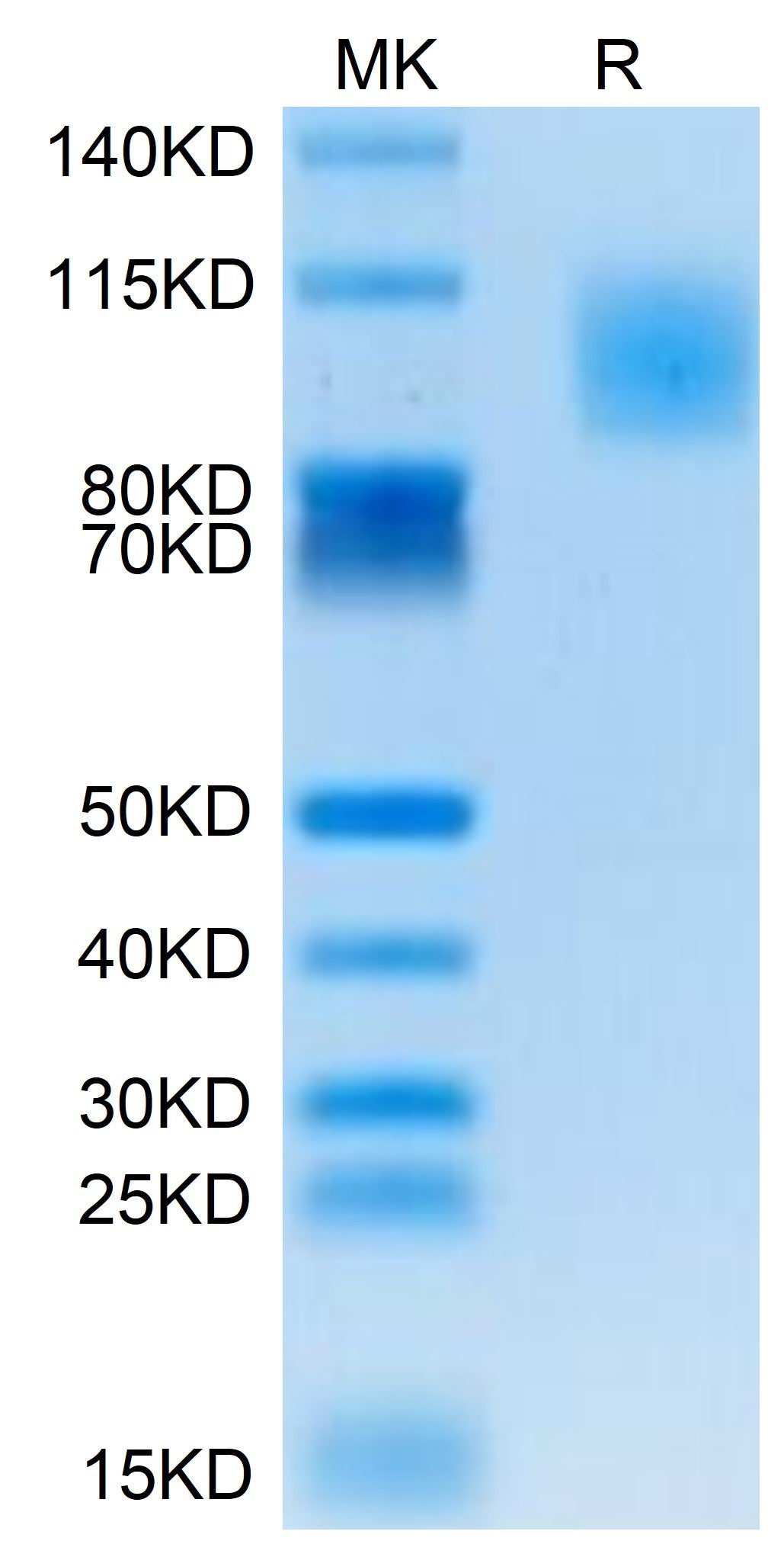 Human PODXL2 Protein, Ultra Low Endotoxin (POD-HM1L2-UL)