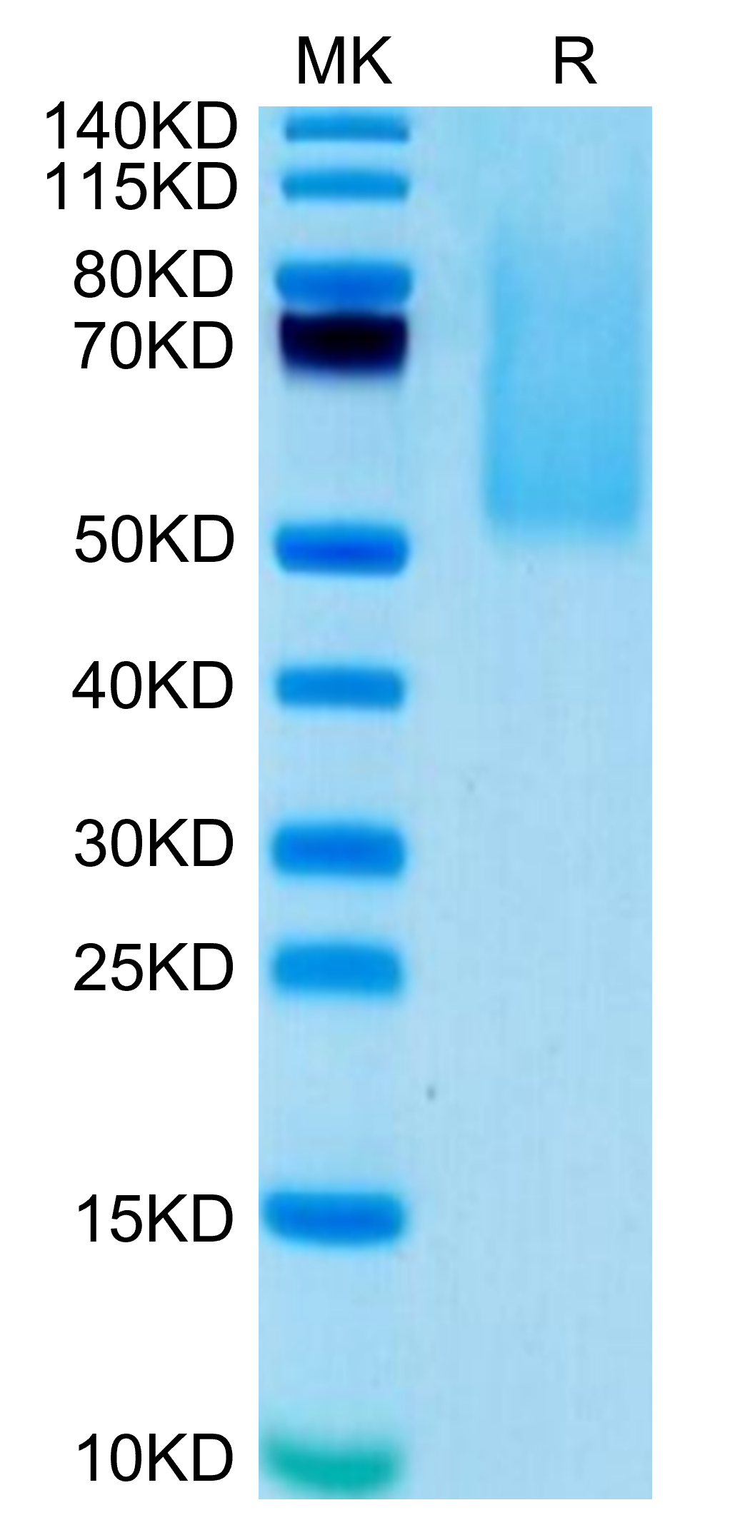 Biotinylated Human CX3CL1/Fractalkine Protein (CX3-HM401B)