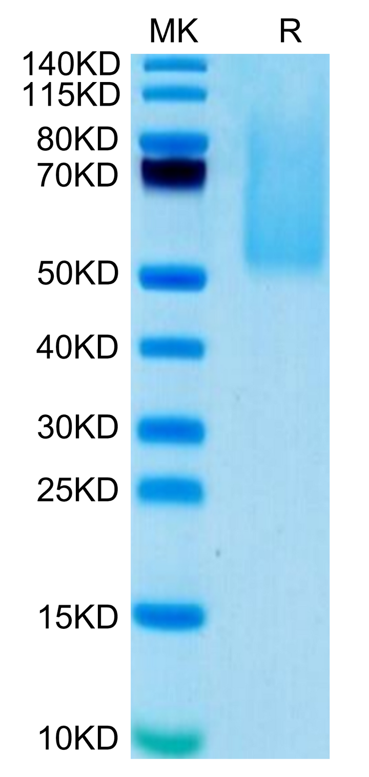 Biotinylated Human CX3CL1/Fractalkine Protein (CX3-HM401B)