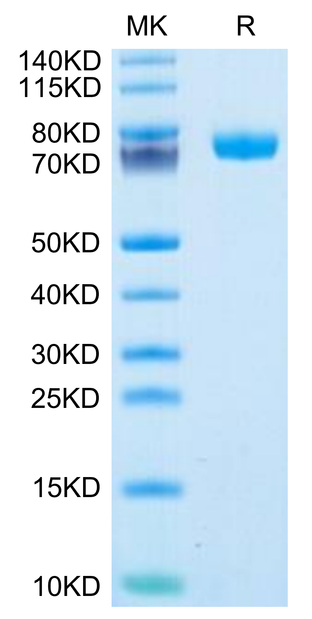 Human FcRH6 /FCRL6 Protein (FCR-HM206)