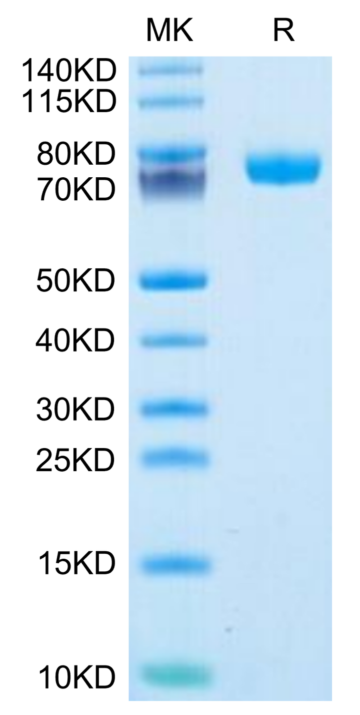 Human FcRH6 /FCRL6 Protein (FCR-HM206)