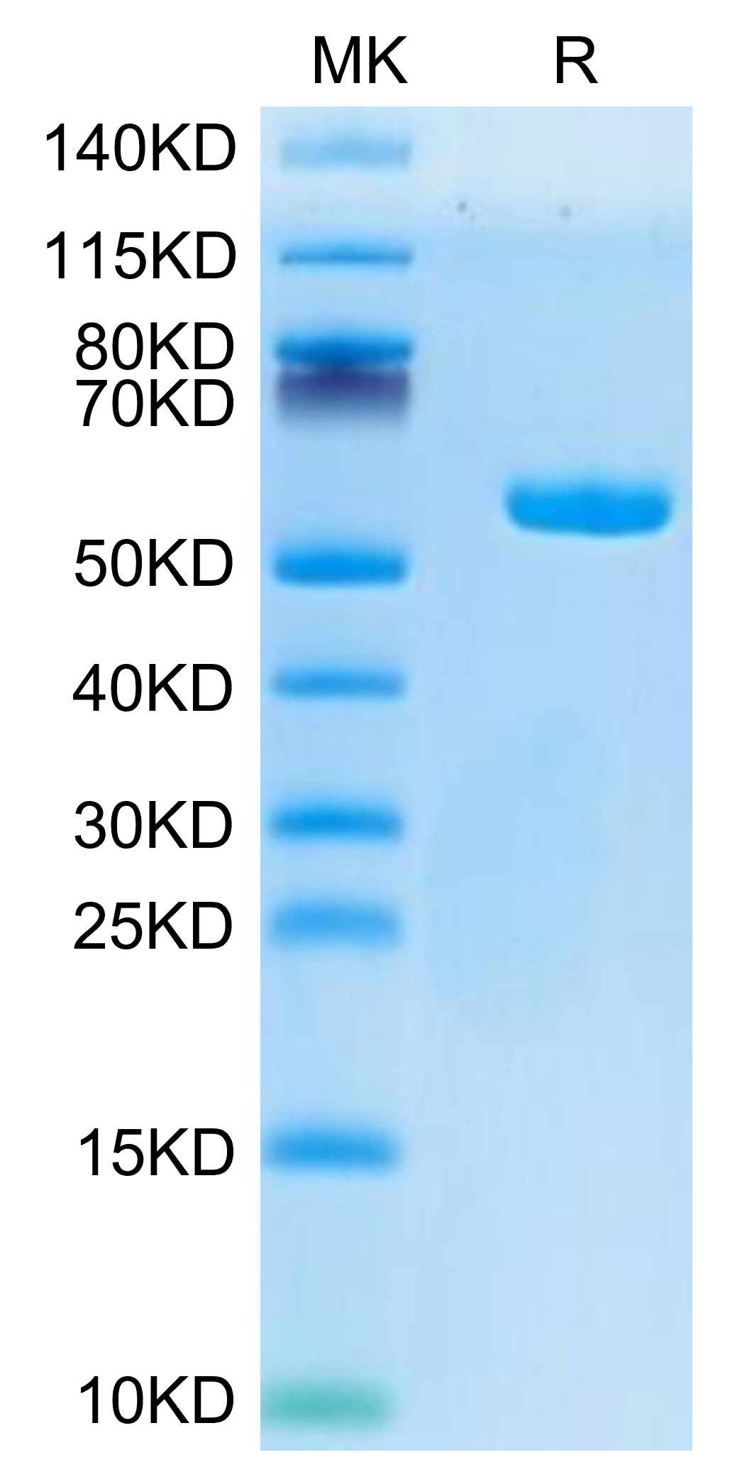 Human HLA-A*02:01&B2M&AFP (PLFQVPEPV) Monomer Protein (MHC-HM408)