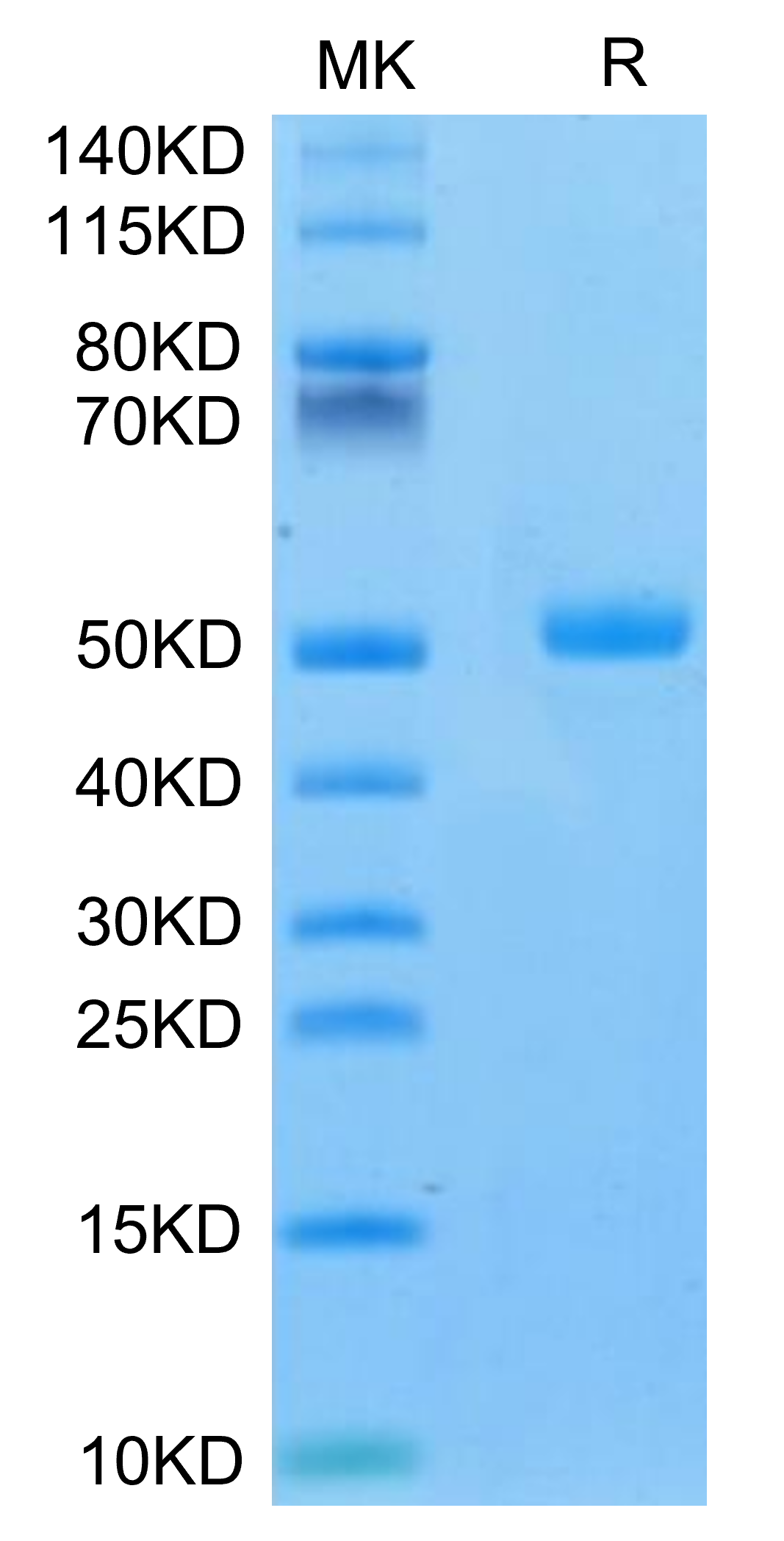 Mouse CA9/Carbonic Anhydrase IX Protein, Ultra Low Endotoxin (CA9-MM101-UL)