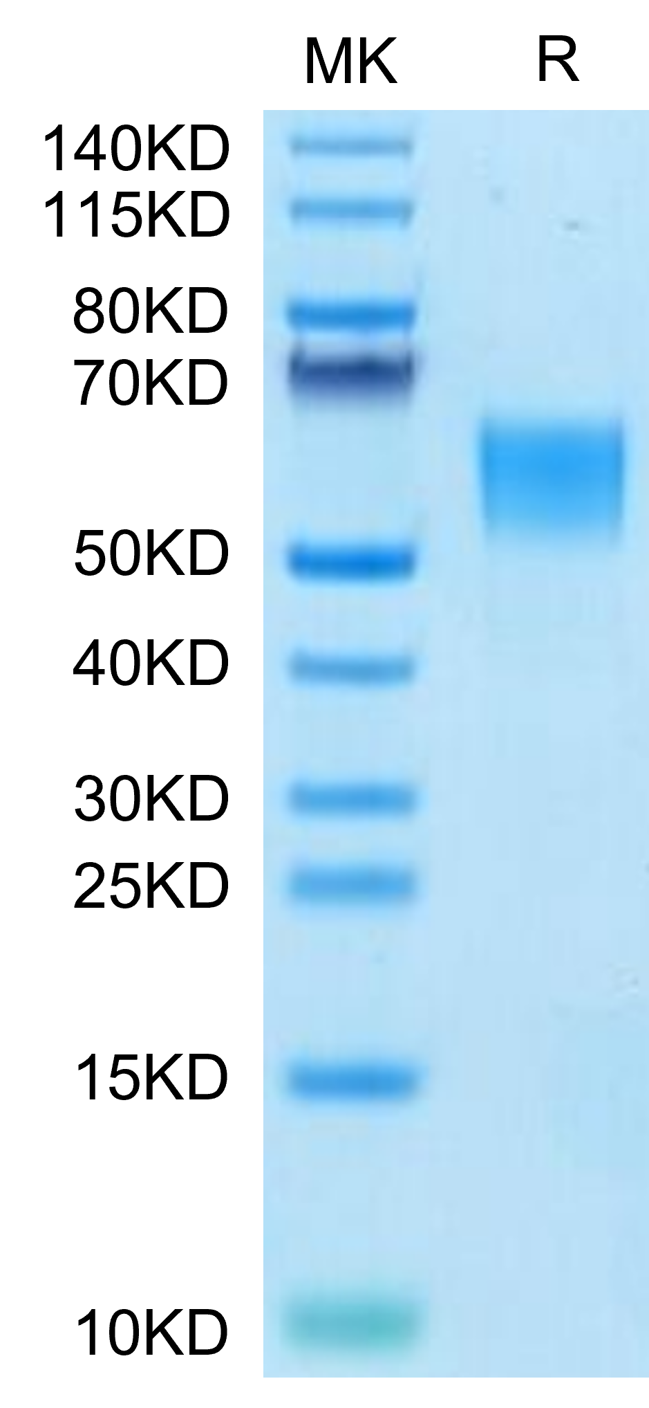 Human ENPP-3 (558-875) Protein (ENP-HM406)