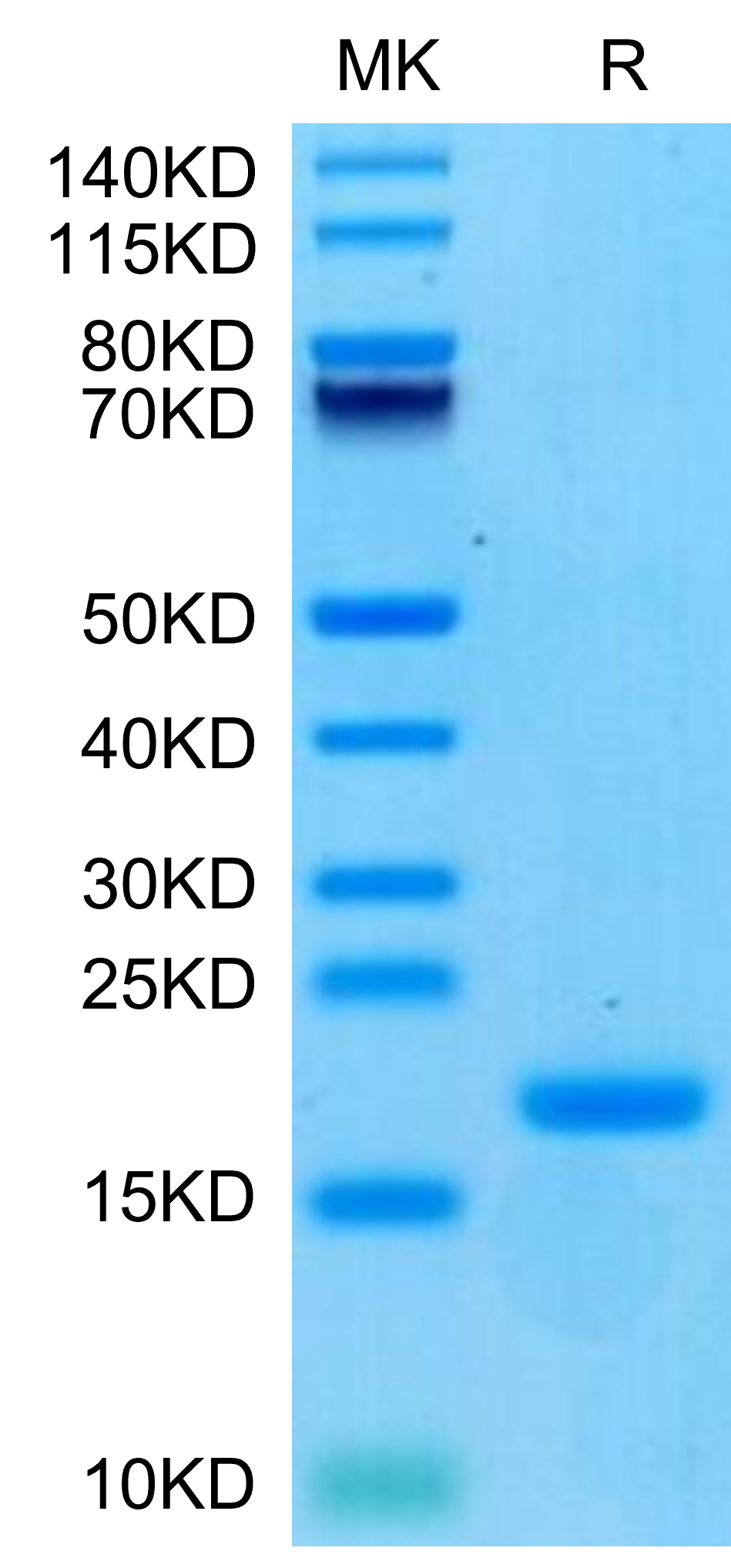 Biotinylated Human ENPP-3 (48-157) Protein (ENP-HM404B)