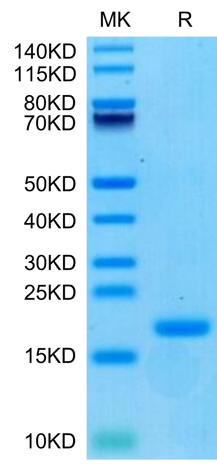 Biotinylated Human ENPP-3 (48-157) Protein (ENP-HM404B)