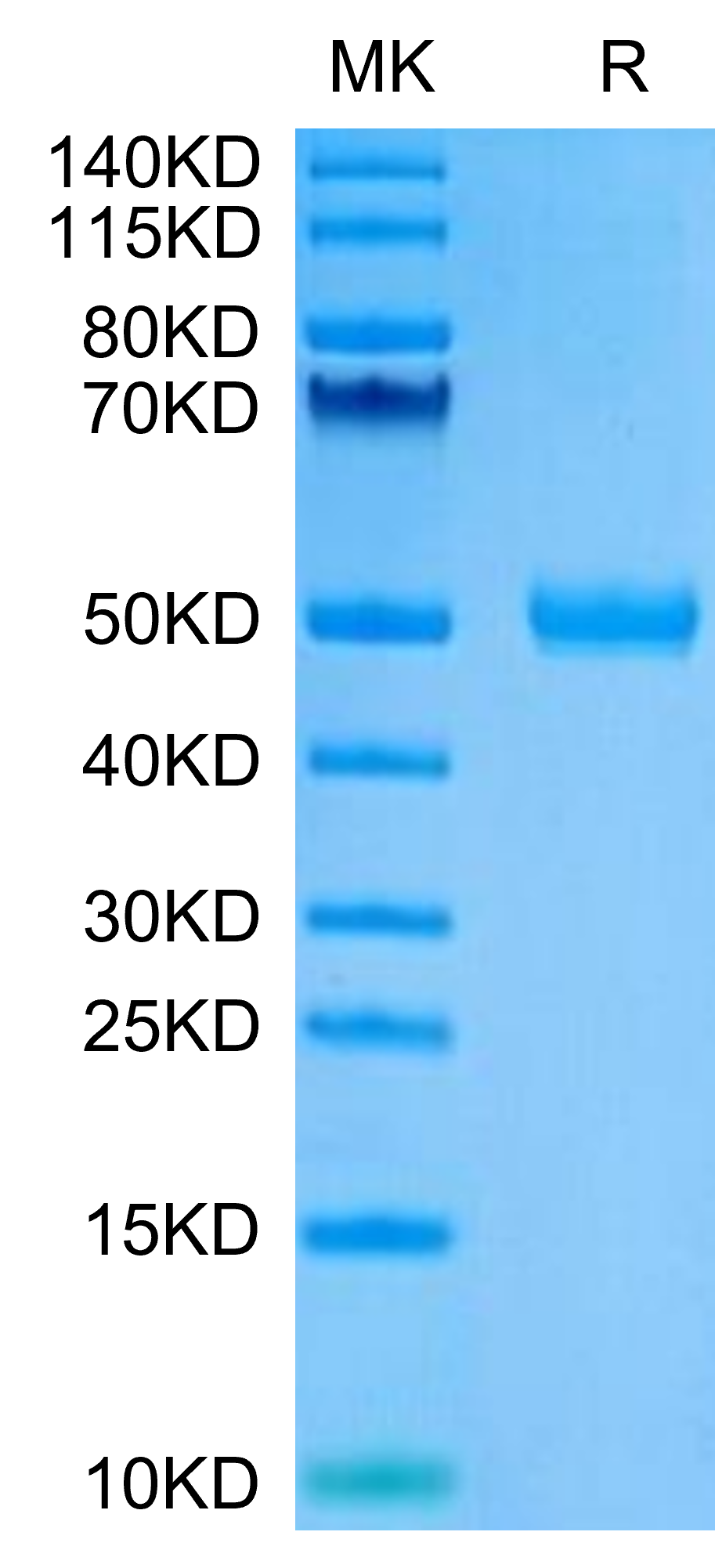 Human CYTL1/C17 Protein (C17-HM217)