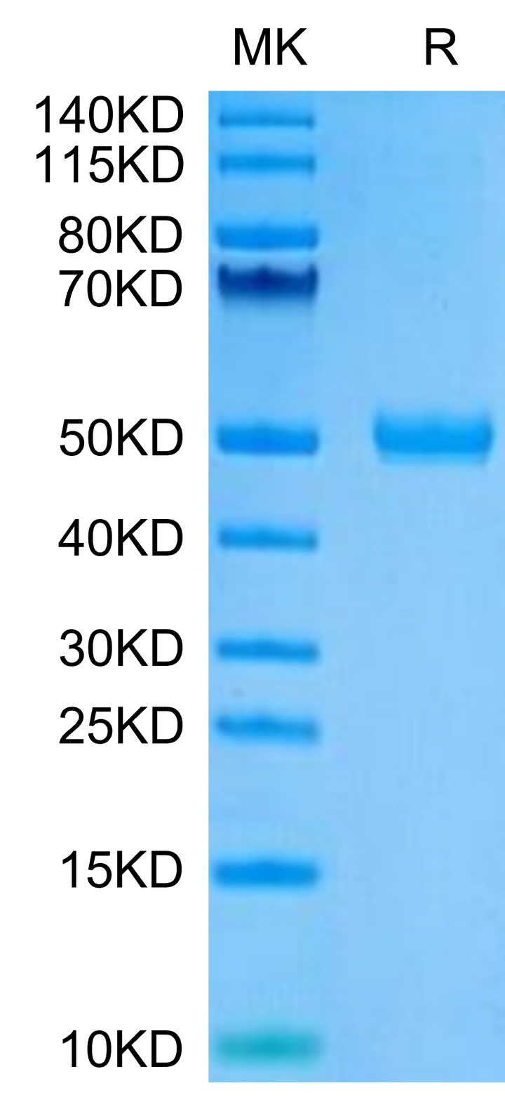 Human CYTL1/C17 Protein (C17-HM217)