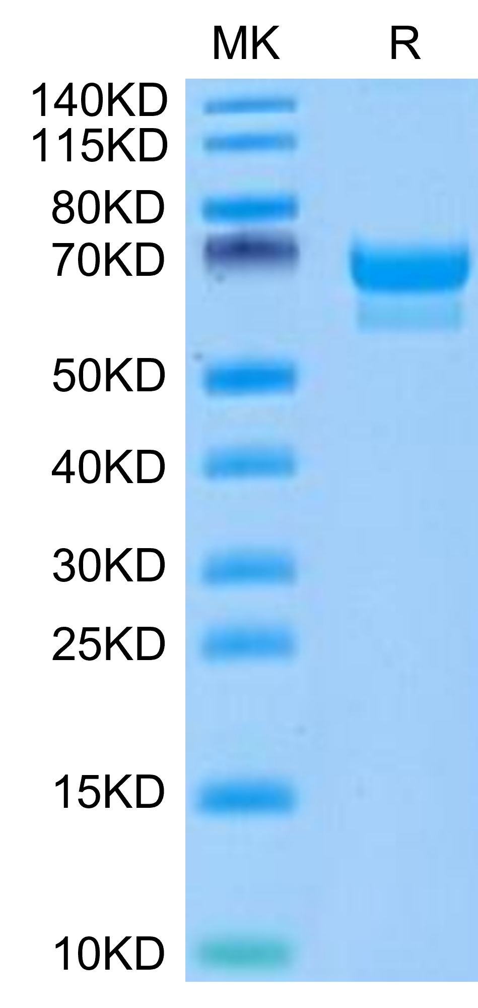 Canine PRLR Protein, Ultra Low Endotoxin (PLR-DM201-UL)