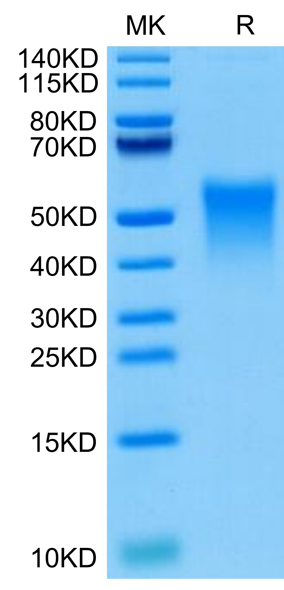 Cynomolgus TREM1 Protein (TRM-CM101)