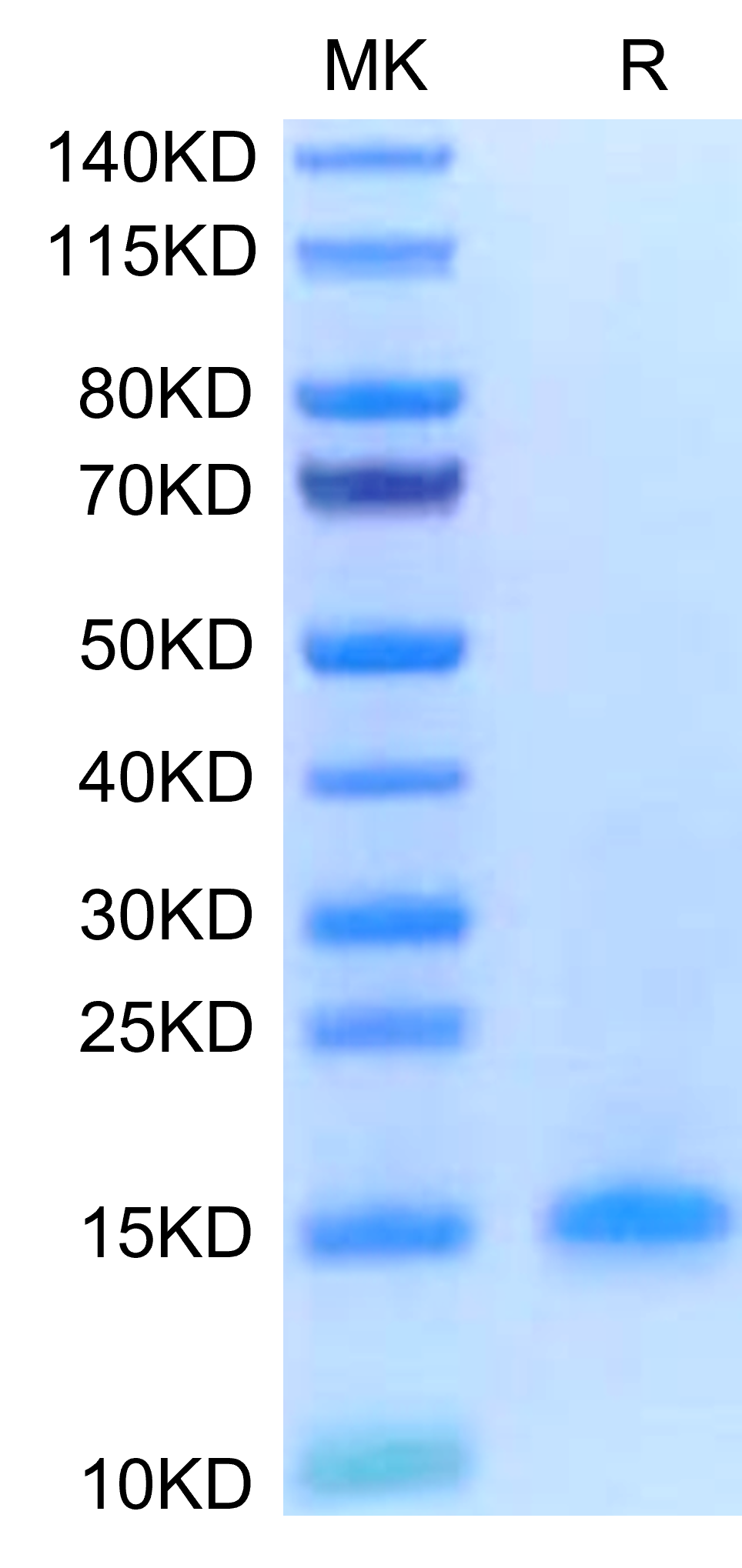 Human CD3D/CD3 delta Protein, Ultra Low Endotoxin (CDD-HM101-UL)