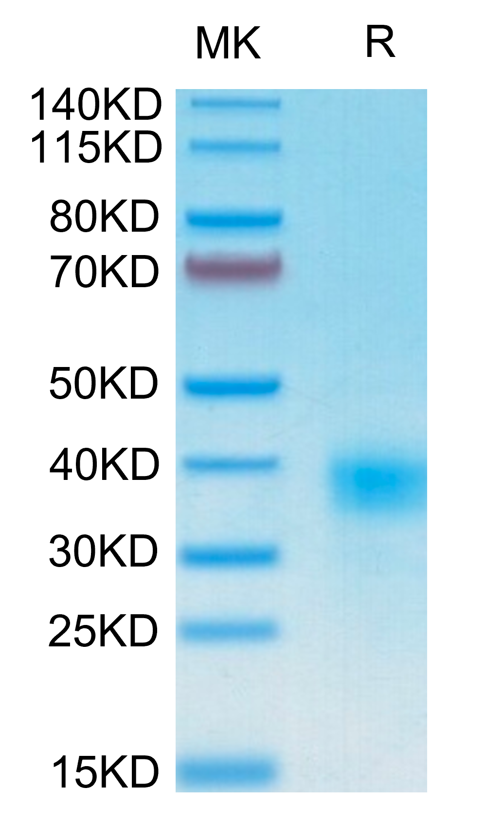 Human CD94 Protein (CD9-HM404)