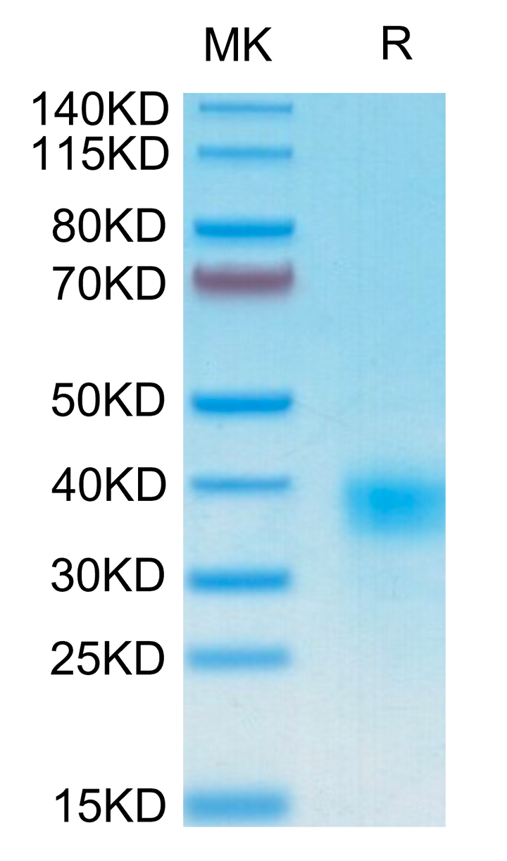 Human CD94 Protein (CD9-HM404)