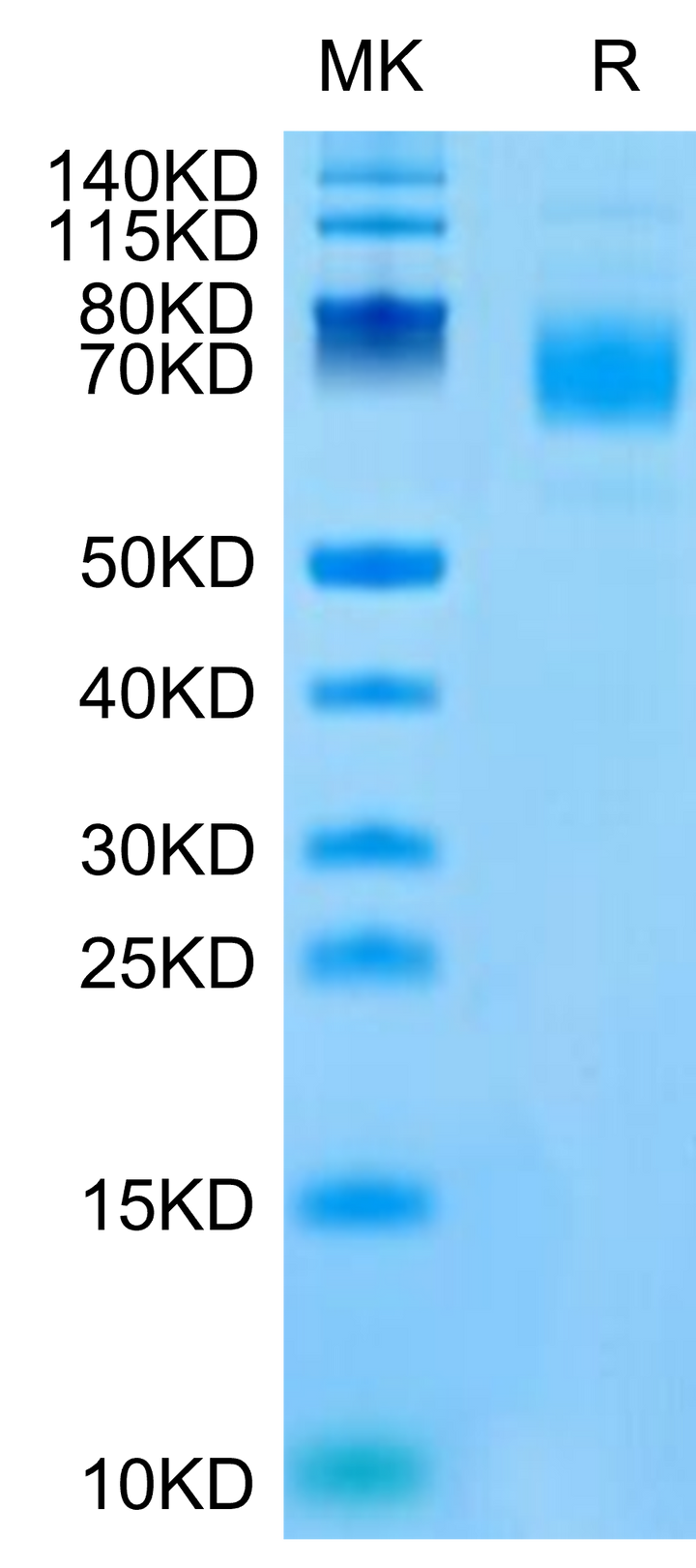 Mouse CSPG5 Protein (SPG-MM105)