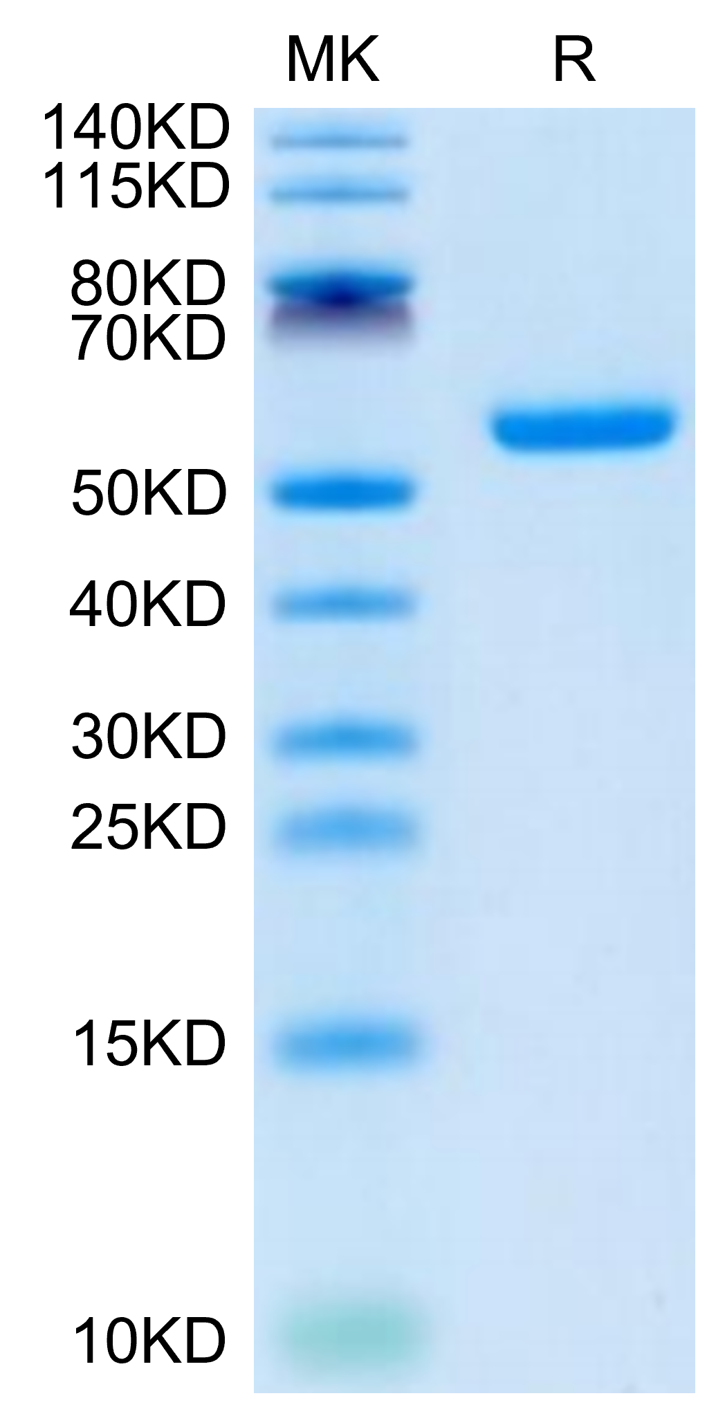 Human CSPG5 Protein (SPG-HM105)