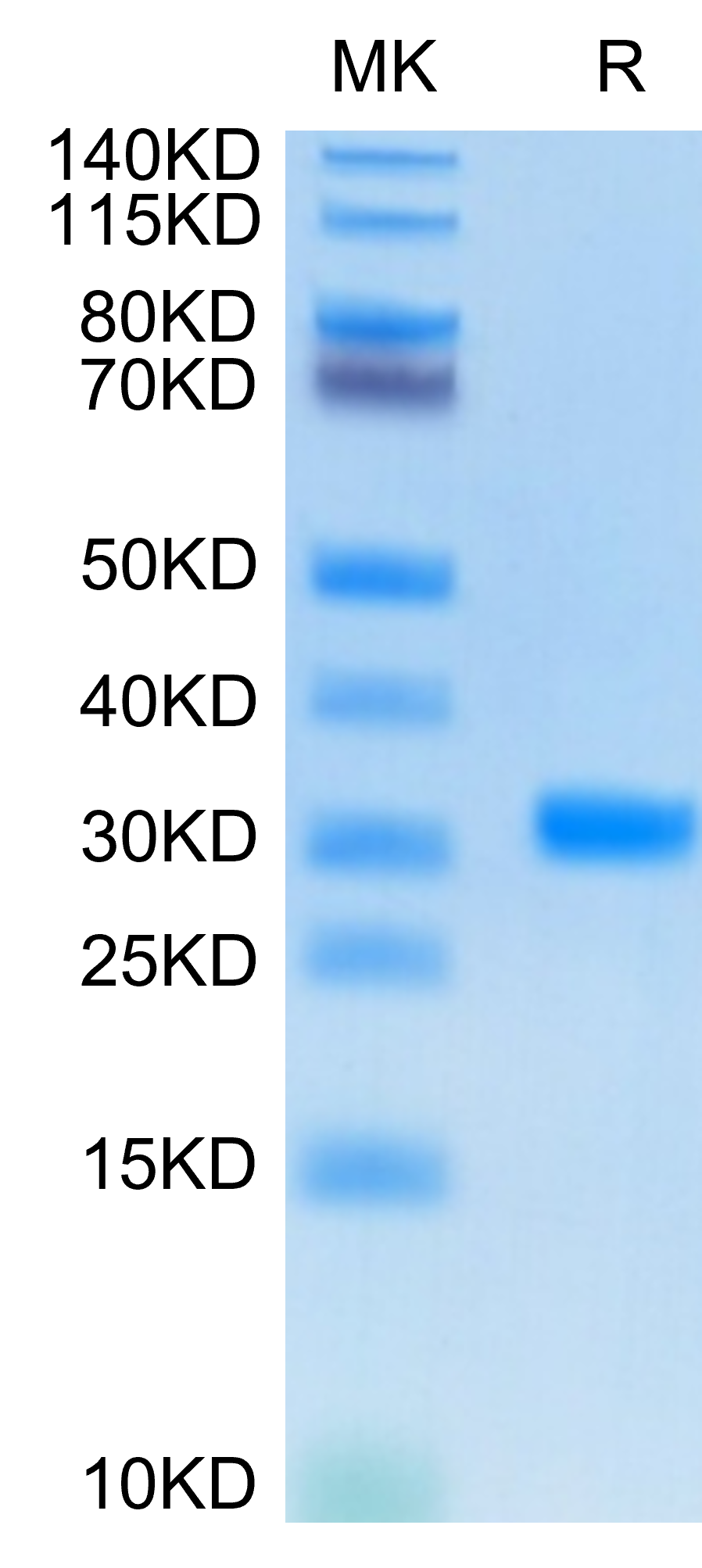 SARS-CoV-2 3CLpro/3C-like Protease Protein (COV-VE0CL)