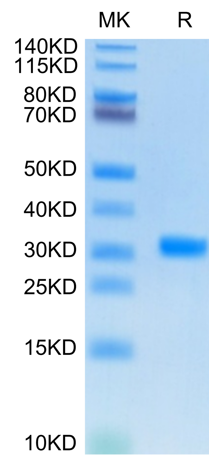 SARS-CoV-2 3CLpro/3C-like Protease Protein (COV-VE0CL)