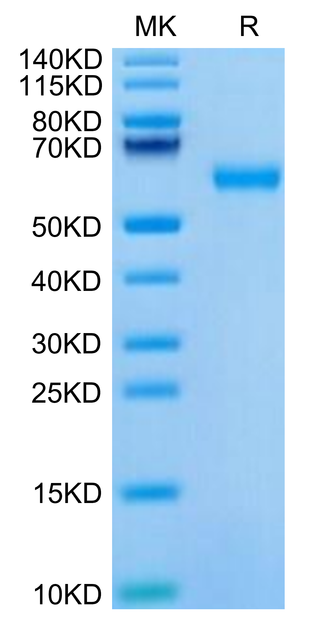 Mouse ROR1 Protein (ROR-MM101)