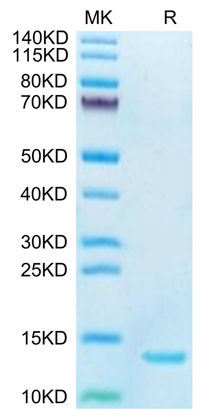 Human DDT Protein (DDT-HE101)