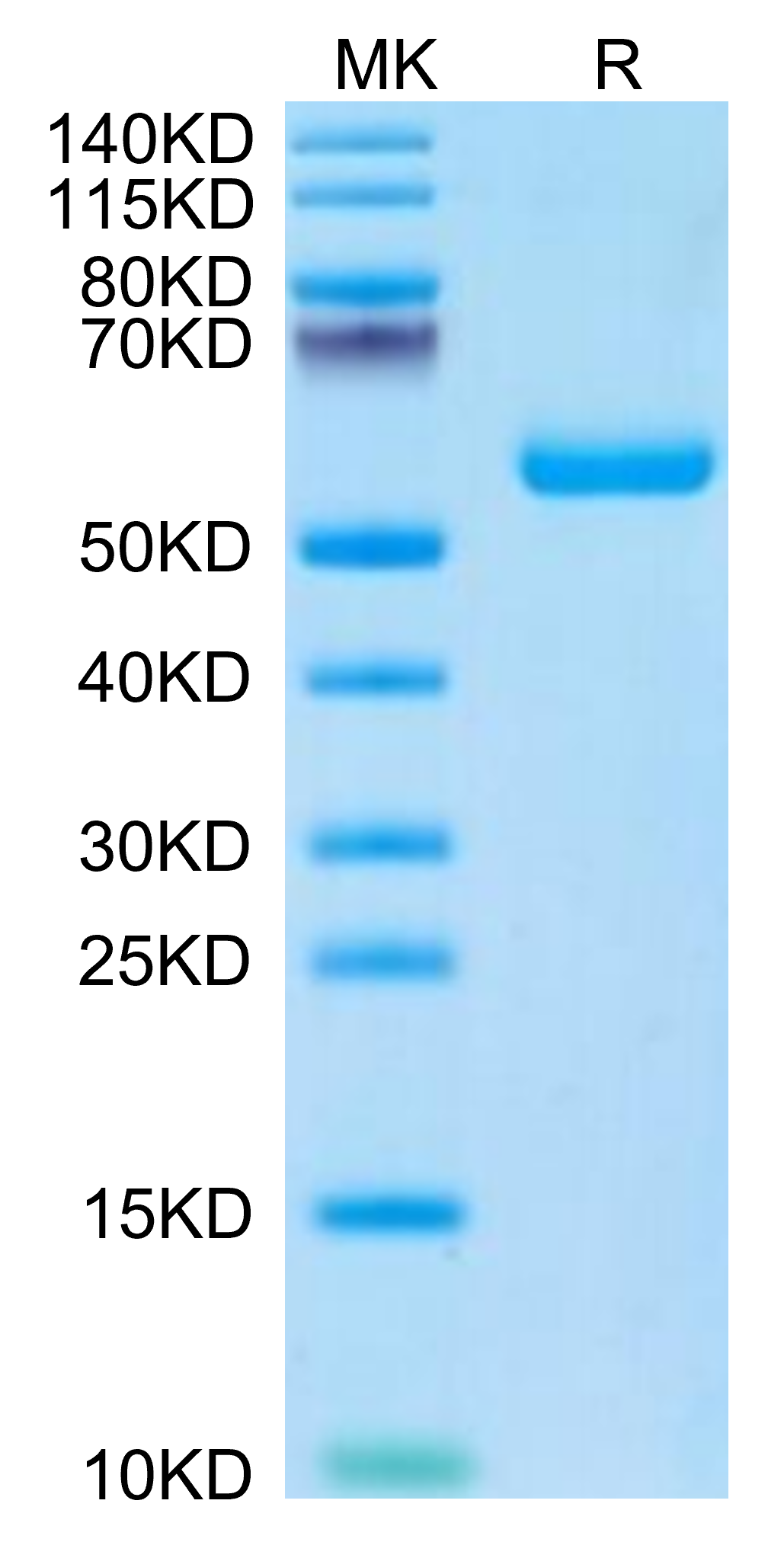 Mouse TIMP-1 Protein, Ultra Low Endotoxin (TIM-MM201-UL)
