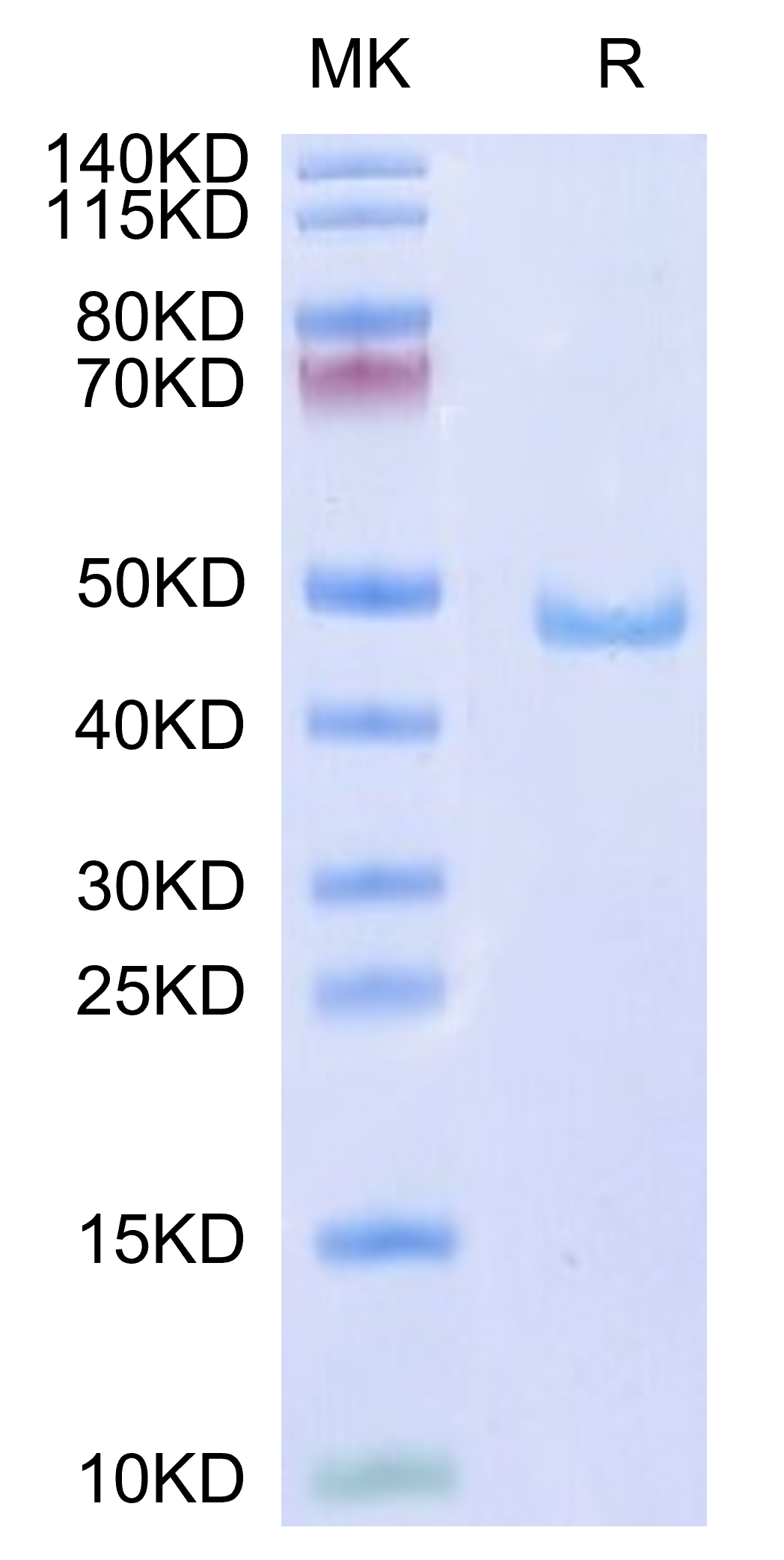 Human CD59 Protein (CD5-HM259)