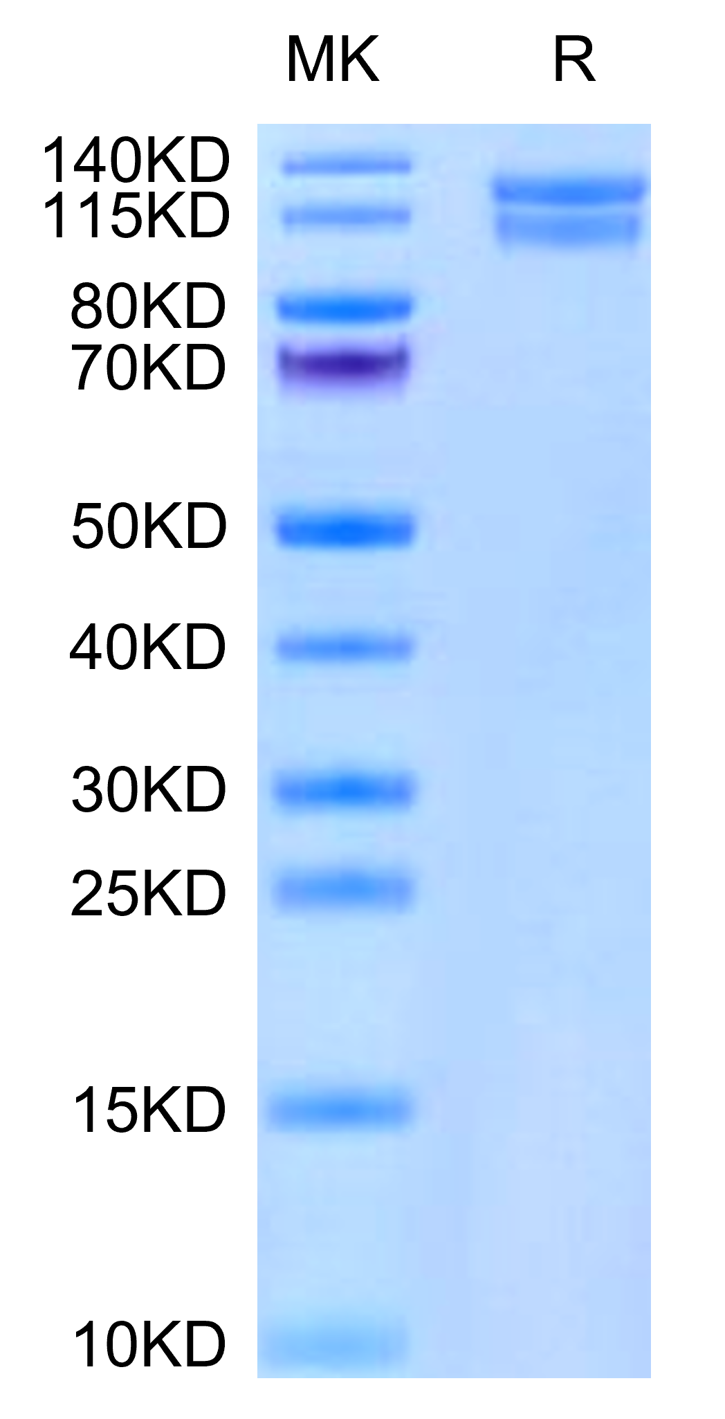 Mouse Integrin alpha 2 beta 1 (ITGA2&ITGB1) Heterodimer Protein (ITG-MM1AB)