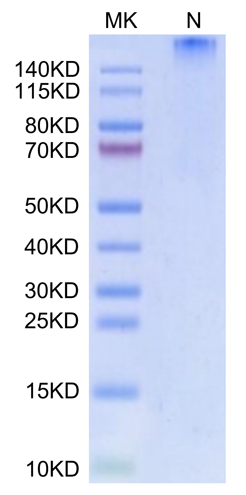 Human HLA-A*01:01&B2M&MAGE-A3 (EVDPIGHLY) Tetramer Protein (MHC-HM427T)