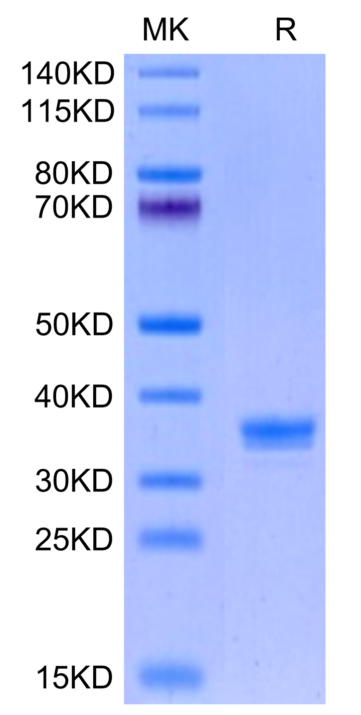 Mouse ANTXR2 Protein (ANT-MM1R2)