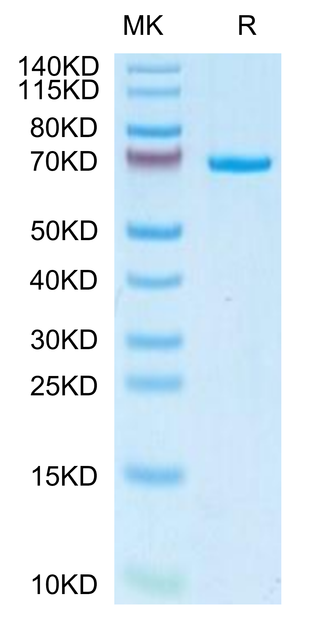 Canine AFP Protein, Ultra Low Endotoxin (AFP-DM101-UL)
