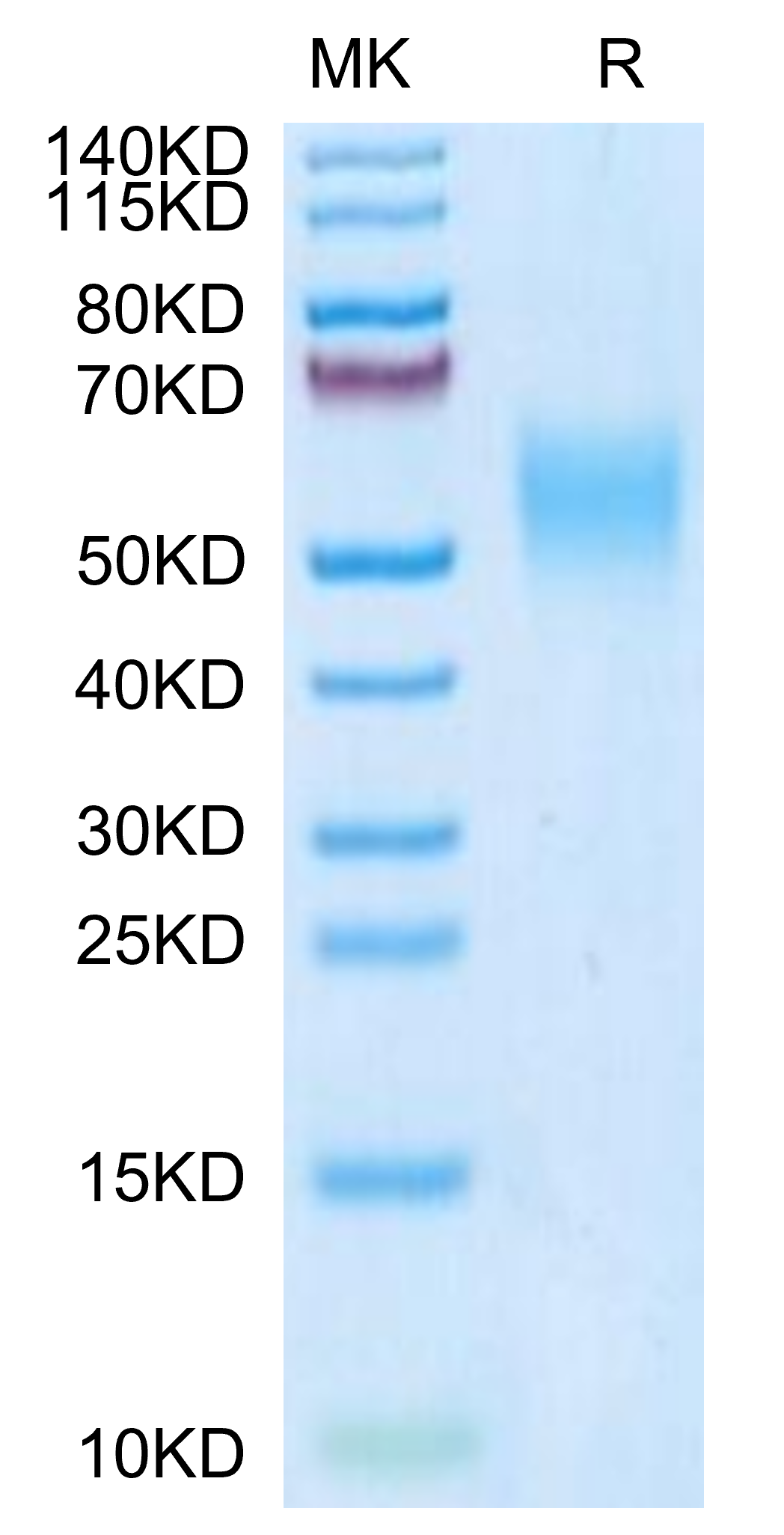 Mouse IL-2 R gamma/CD132 Protein (CD1-MM132)