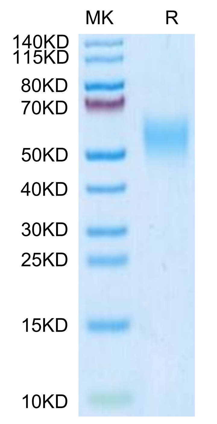 Mouse IL-2 R gamma/CD132 Protein (CD1-MM132)