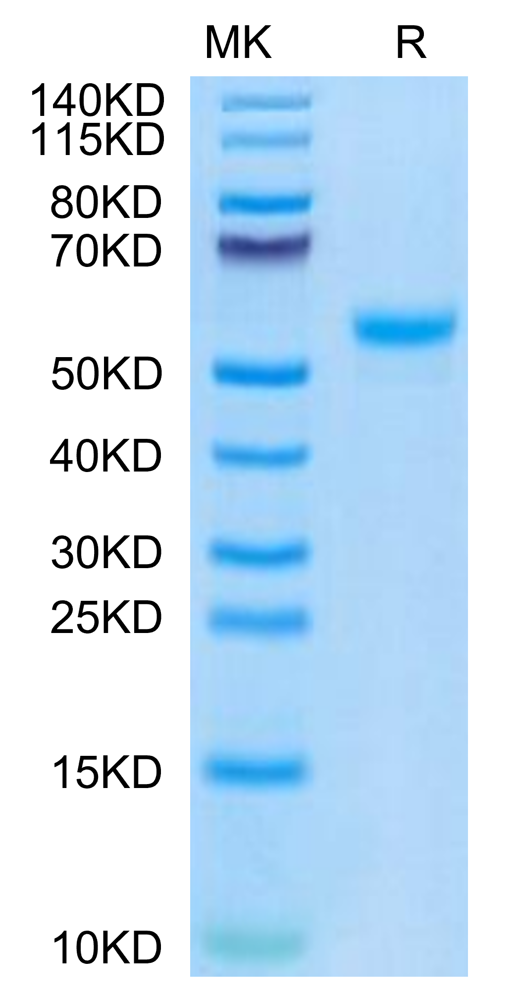 Mouse CPM Protein (CPM-MM101)