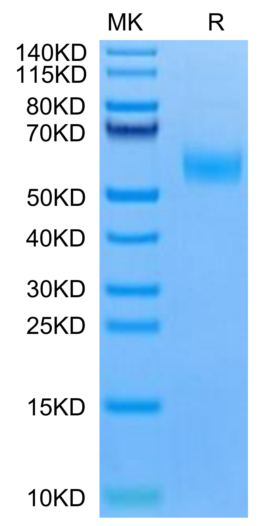 Mouse EDA2R Protein (EDA-MM22R)