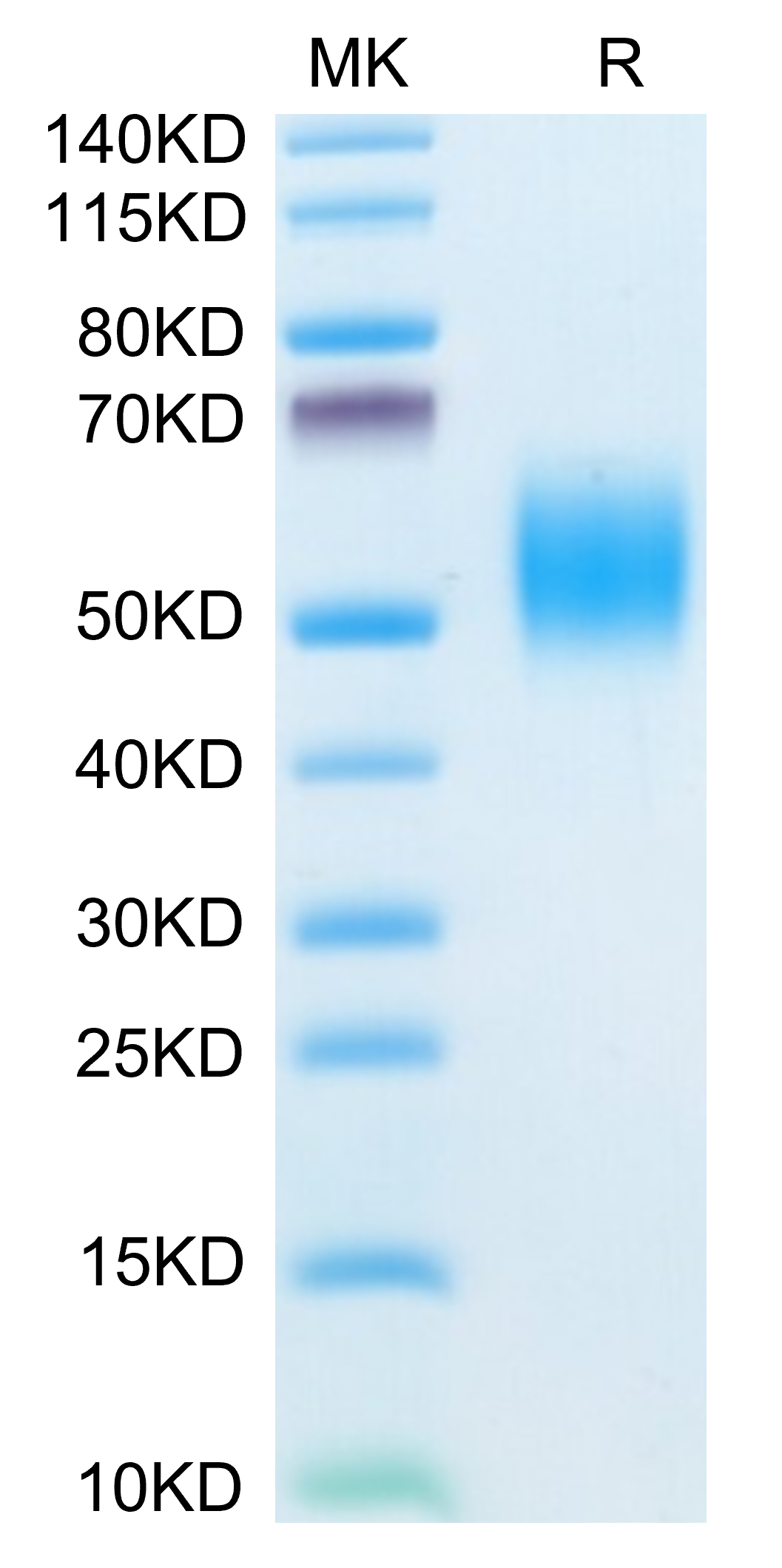 Mouse FGFR2 beta (IIIb) Protein (FGF-MM1BB)