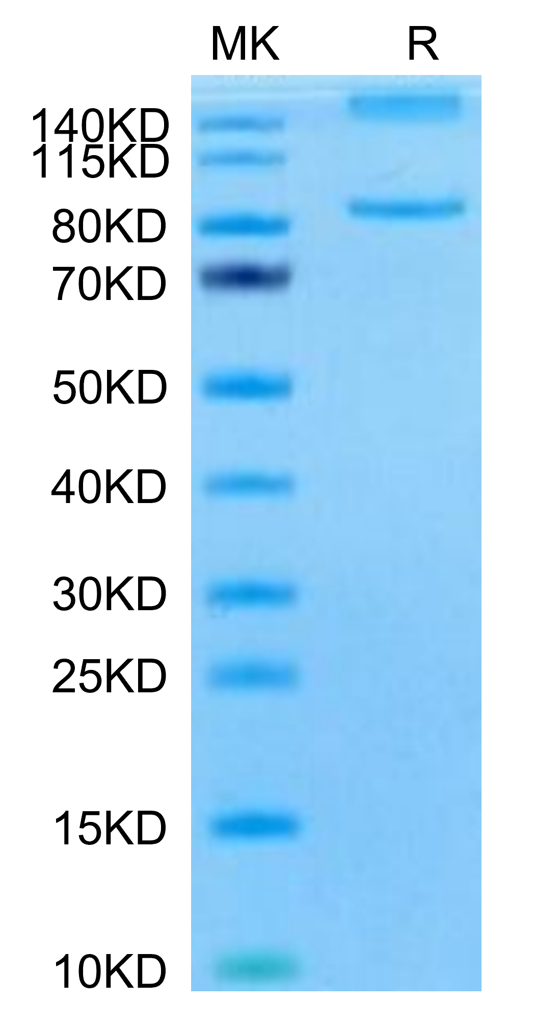 Mouse Integrin alpha L beta 2 (ITGAL&ITGB2) Heterodimer Protein, Ultra Low Endotoxin (ITG-MM1LB-UL)