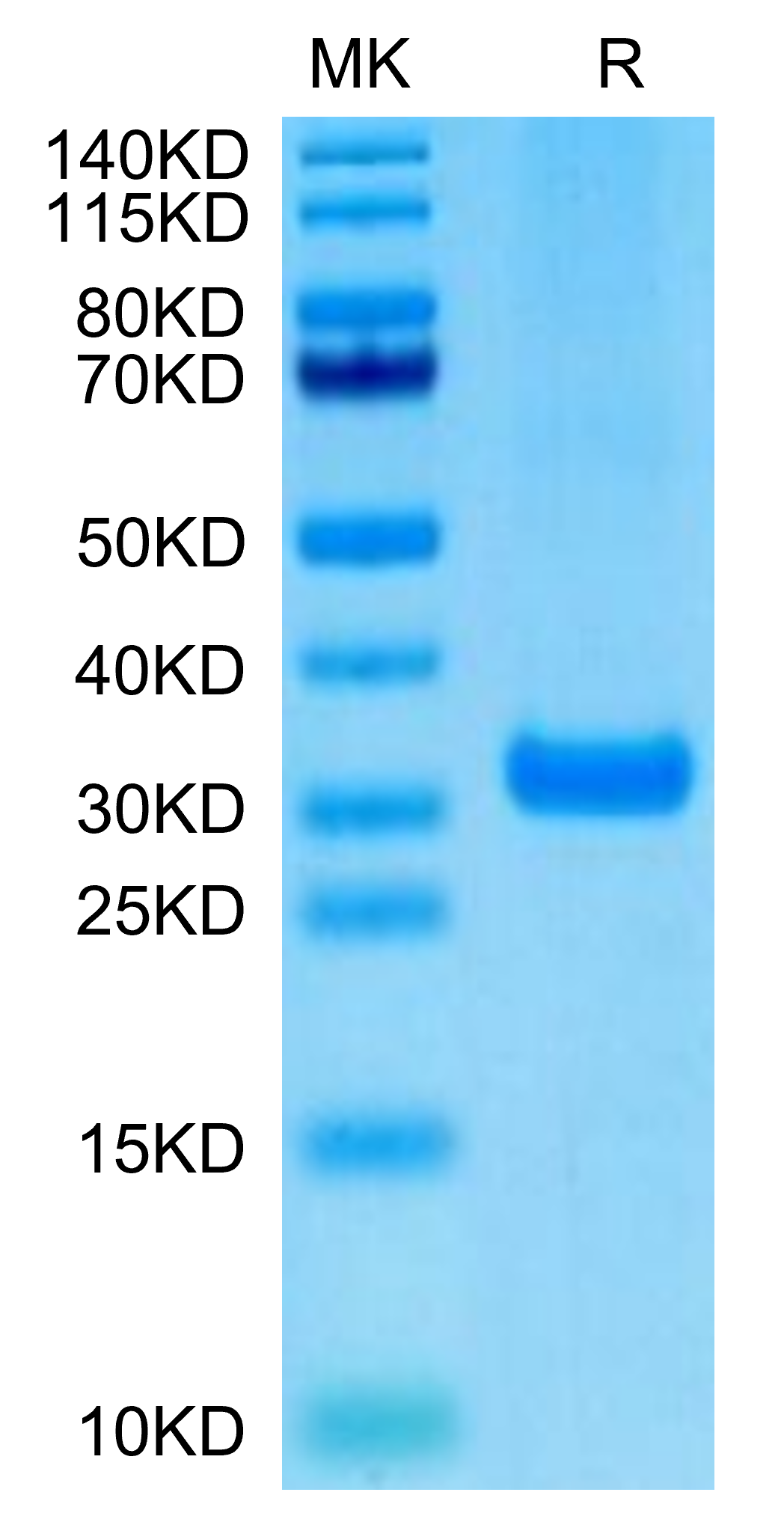 Biotinylated Human BTN3A2 Protein (BNT-HM4A2B)