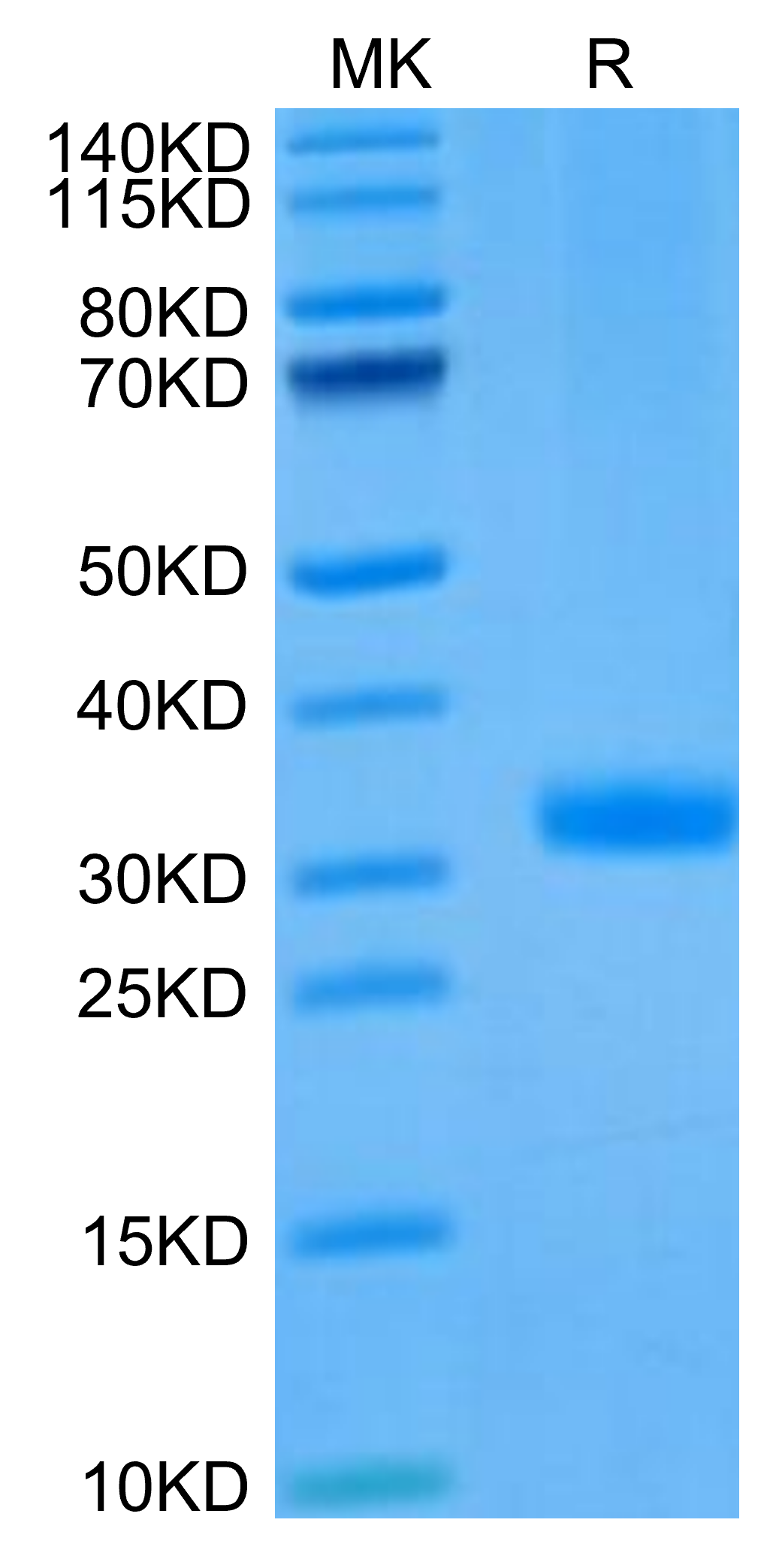 Mouse ANGPT2/Angiopoietin-2 Protein, Ultra Low Endotoxin (APN-MM101-UL)