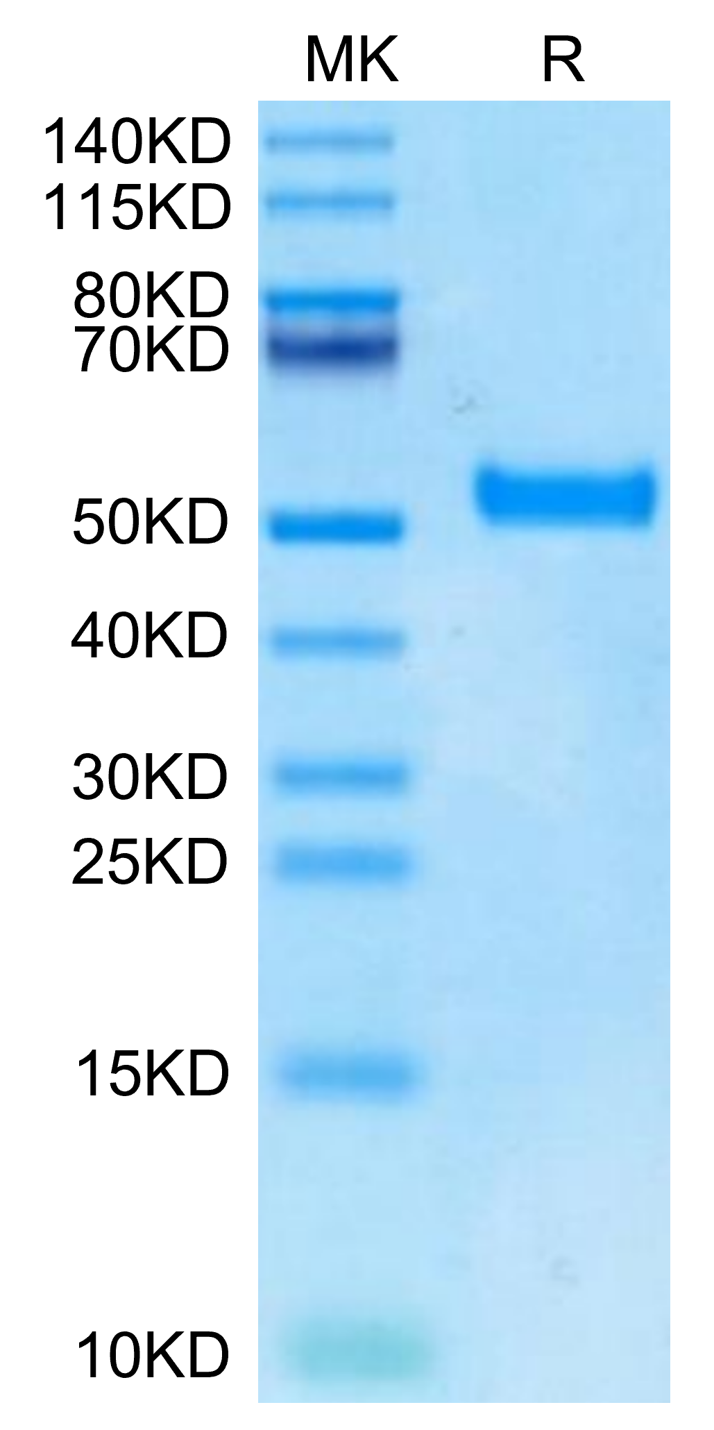 Biotinylated Human DKK1 N terminal Domain Protein (DKK-HM50NB)