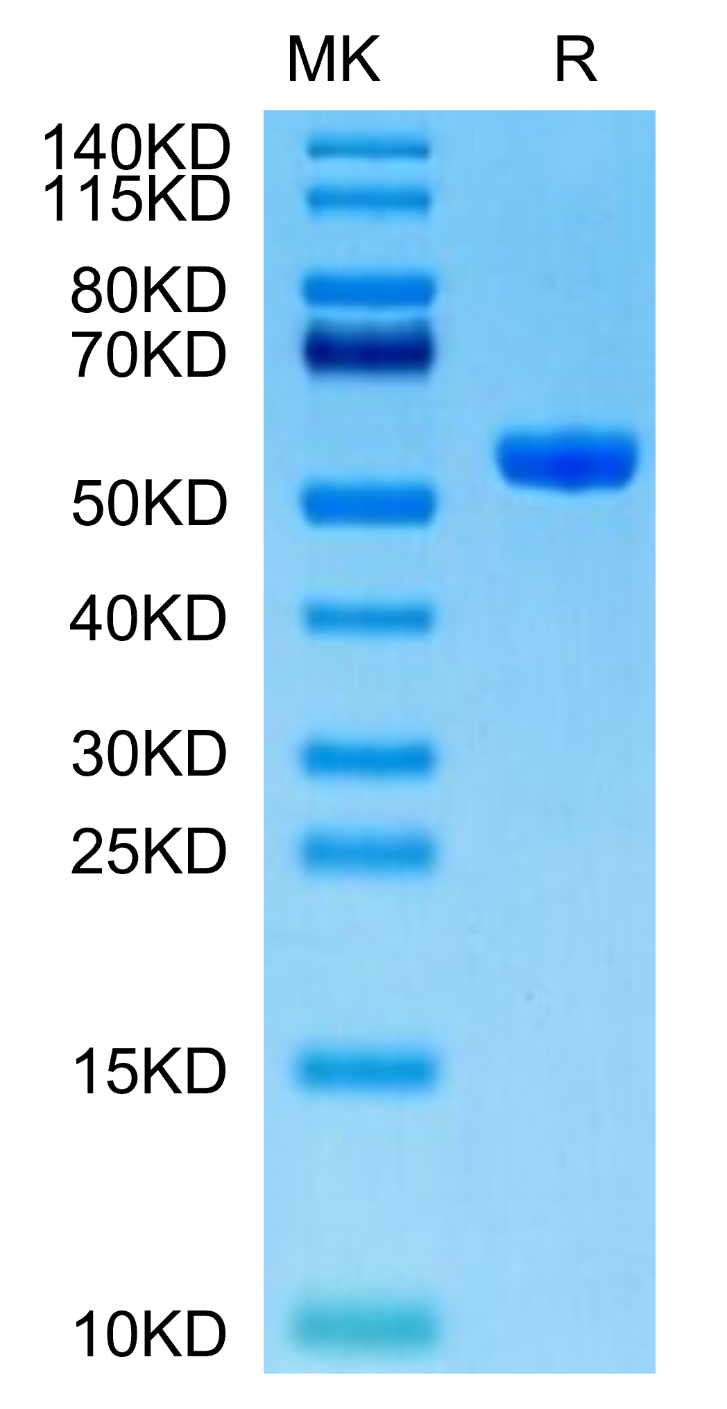 Human HLA-A*11:01&B2M&KRAS WT (VVVGAGGVGK) Monomer Protein, Ultra Low Endotoxin (MHC-HM429-UL)