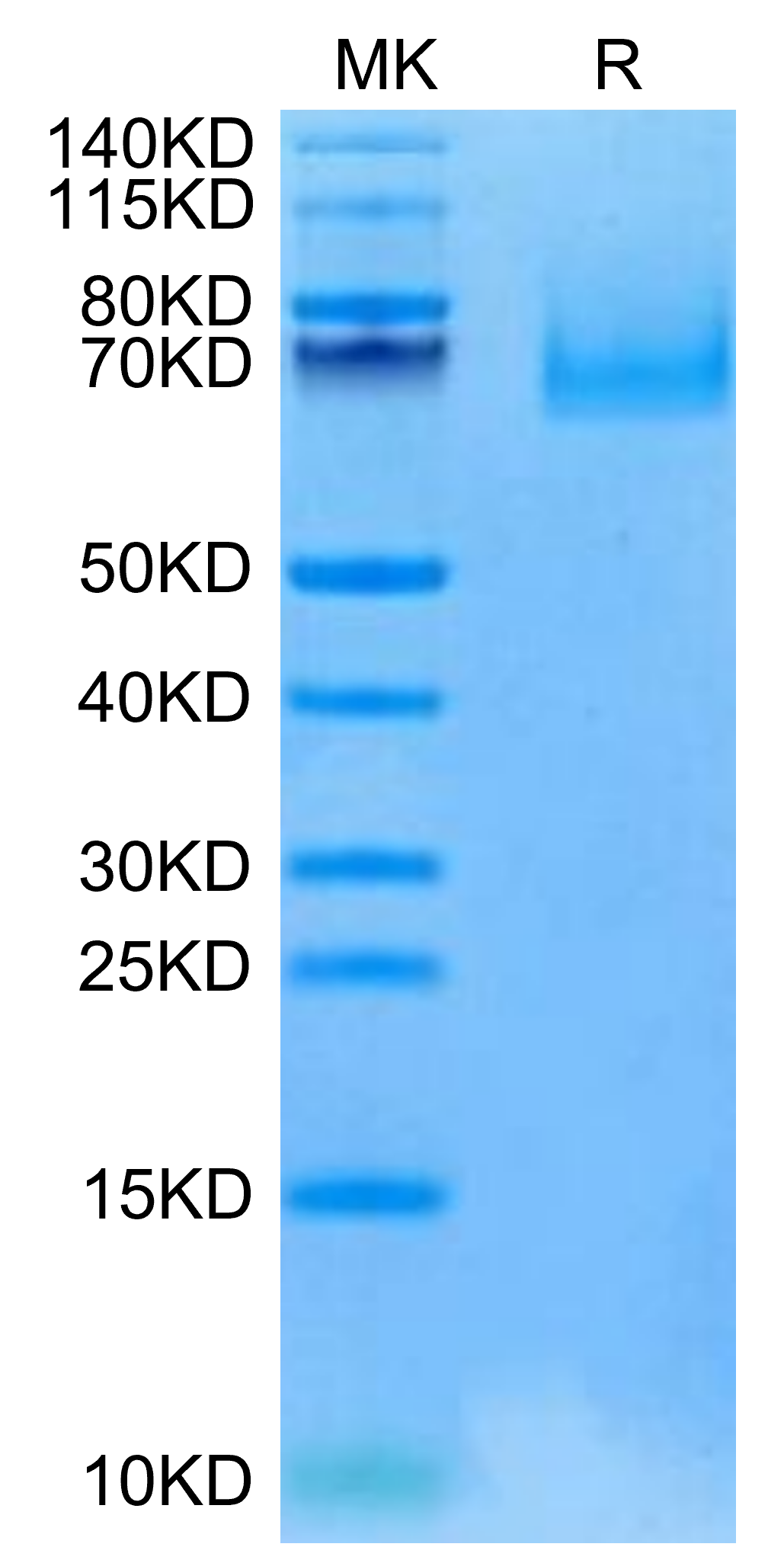 Cynomolgus EPHA10 Protein, Ultra Low Endotoxin (EPH-CM110-UL)