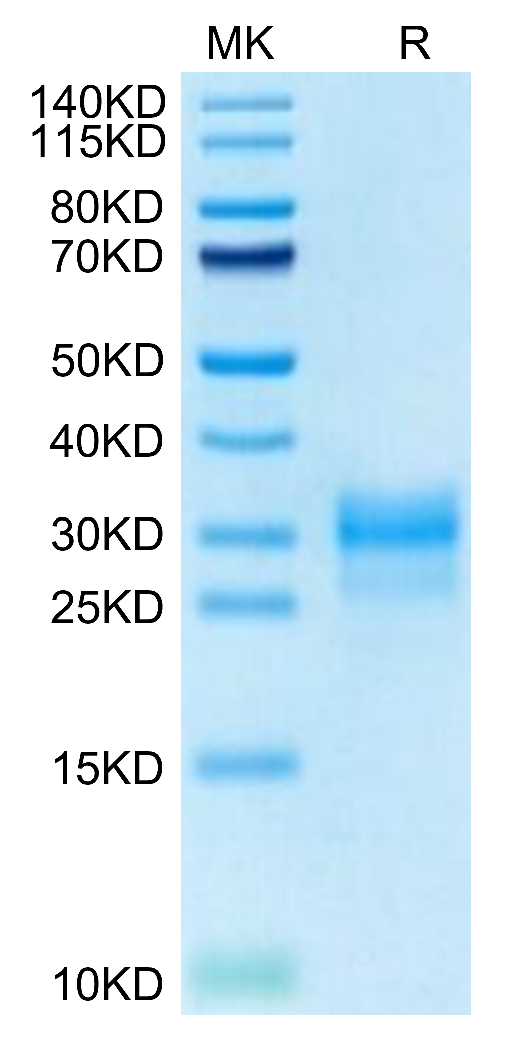 Cynomolgus IL-1 alpha/IL-1A Protein (IL1-CM10A)