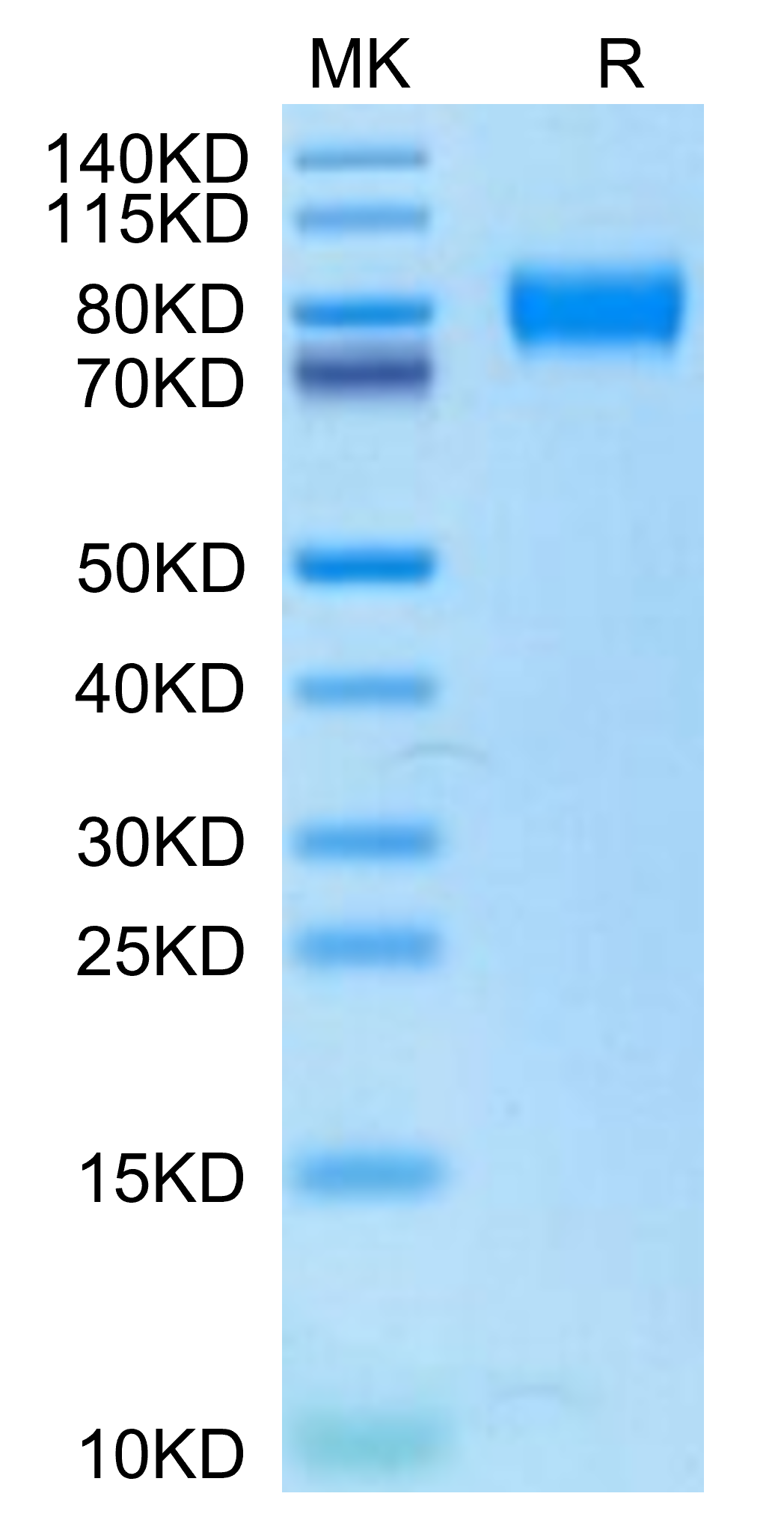 Human IL-2 R gamma/CD132 Protein (CD1-HM232)