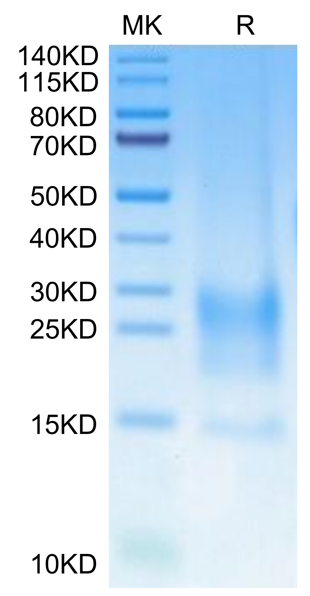 Cynomolgus BST2 Protein, Ultra Low Endotoxin (BST-CM202-UL)