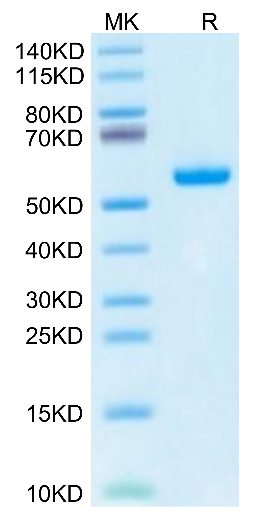 Human HLA-A*02:03&B2M&AFP (FMNKFIYEI) Monomer Protein (MHC-HM432)