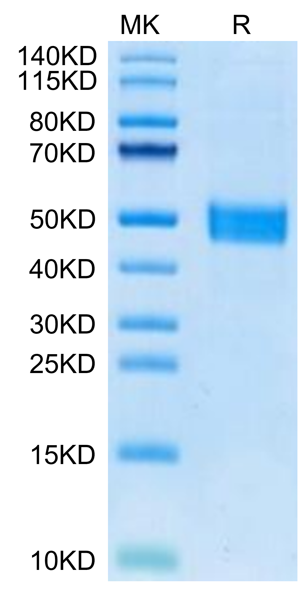 Mouse FSTL1 Protein (FST-MM1L1)