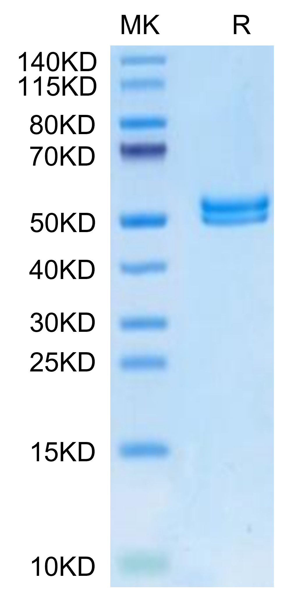 Mouse IL-11R alpha Protein, Ultra Low Endotoxin (ILR-MM111-UL)