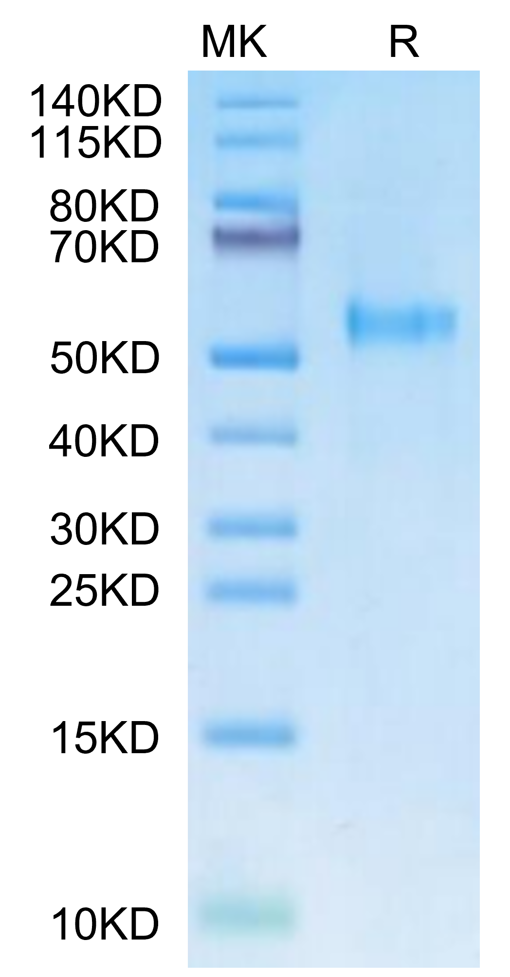 Rhesus macaque KIR3DL3 Protein (KR3-CM1L3)